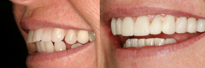 Dr Smile: przed i po